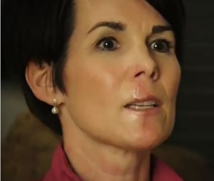 News Anchor Bitten By Dog Speaks Out